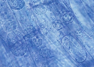 Dans les cellules du cortex racinaire des plantes malades, on peut observer facilement la présence de sporanges et de spores de repos du champignon vecteur : <i>Olpidium brassicae</i>. <b>Agent des anneaux nécrotiques de la laitue</b> (<i>Lettuce ring necrosis agent</i>, LRNA)