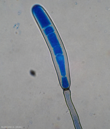 Una giovane conidia colorata di blu si è formata all'estremità di conidiofori melanizzati di <b><i>Corynespora cassiicola</b></i>. (corynesporiosi)