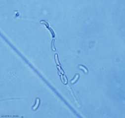 Otto ascospore ialine e arcuate sono visibili in un asco di <i> <b> Eutypa lata </b> </i>.