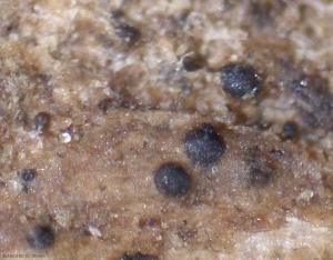 Pycnidi marroni e globulari sono ben visibili nei tessuti. <b><i>Didymella lycopercisi</i></b> (macchie a <i>Didymella</i>, <i>Didymella</i> leaf spot)