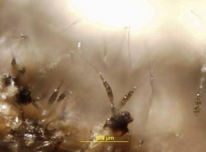 Des conidiophores et des conidies d'<b><i>Alternaria tomatophila</i></b> sont observables à la loupe binoculaire sur les tissus lésés. Les spores de ce champignon, pluricellulaires et allongées, sont solitaires et pourvues d'un prolongement hyalin filiforme. <b>Alternariose (early blight)</b> (Bruce WATT - University of Maine)