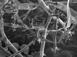 Zoospore di <i> <b>Plasmopara viticola </i></b> germinato sulla superficie di una foglia di vite (visto al microscopio a scansione).  (Nathalie PICHON)