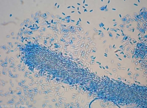 Aspetto al microscopio ottico di una cirra di spore alfa di <b> <i> Phomopsis viticola </i> </b>.