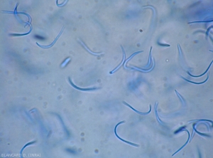 Aspetto al microscopio ottico di un cirro di spore beta di <b> <i> Phomopsis viticola </i> </b>.