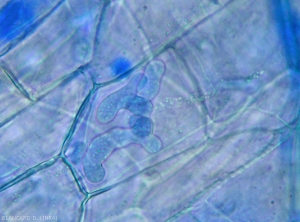 Pythium-Mycelium2