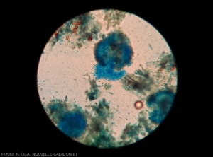 Spores émergeant d'une pycnide d'un <i><b>Phoma</i> sp.</b> responsable de la criblure du taro.