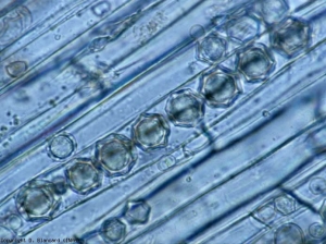 Spore stellate a riposo di <b> <i> Olpidium brassicae </i> </b> si sono sviluppate in diverse cellule della corteccia.