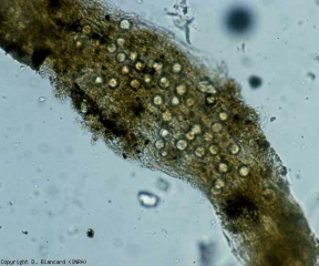 Numerose oospore si sono formate nelle cellule della corteccia di questa radice alterata <b> <i> Pythium </i> sp. </b> (smorzamento, marciume radicale e basale)