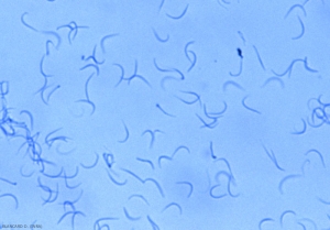 Le spore beta di <b> <i> Phomopsis viticola </i> </b> sono lunghe, filiformi e arcuate.