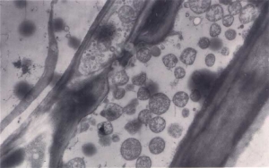 Várias estruturas mais ou menos esféricas nas veias do floema são observadas por microscopia eletrônica. <b>Fitoplasma causando stolbur</b>