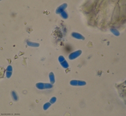 Os pycniosporos têm ou não uma divisória. Suas dimensões variam de conicidade para conicidade (3-11 x 2-4,5 μm). <b><i>Didymella lycopersici</i></b> (cancro em <i>Didymella</i>, <i>Didymella</i> stem canker and fruit rot)