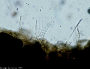 Vários nematóides penetraram mais ou menos profundamente no córtex desta raiz de tomate. <b><i>Pratylenchus</i> spp.</b> (nematóides com podridão radicular, lesão de nematóides)